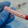 Ebola Virus Blood Vial